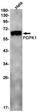 PDPK1 Rabbit mAb